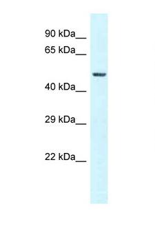 GC / Vitamin D-Binding Protein Antibody - GC / VDBP antibody Western blot of 721_B Cell lysate. Antibody concentration 1 ug/ml.  This image was taken for the unconjugated form of this product. Other forms have not been tested.