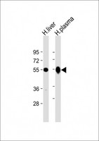 GC / Vitamin D-Binding Protein Antibody - All lanes: Anti-GC Antibody (C-Term) at 1:2000 dilution Lane 1: human liver lysate Lane 2: human plasma lysate Lysates/proteins at 20 µg per lane. Secondary Goat Anti-Rabbit IgG, (H+L), Peroxidase conjugated at 1/10000 dilution. Predicted band size: 53 kDa Blocking/Dilution buffer: 5% NFDM/TBST.