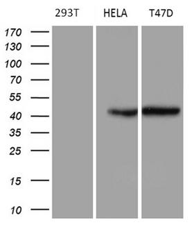 GC / Vitamin D-Binding Protein Antibody - Western blot analysis of extracts. (35ug) from 3 different cell lines by using anti-GC monoclonal antibody. (HeLa: human; 293T: human; T47D: human). (1:500)