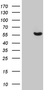 GC / Vitamin D-Binding Protein Antibody - HEK293T cells were transfected with the pCMV6-ENTRY control. (Left lane) or pCMV6-ENTRY GC. (Right lane) cDNA for 48 hrs and lysed. Equivalent amounts of cell lysates. (5 ug per lane) were separated by SDS-PAGE and immunoblotted with anti-GC. (1:2000)