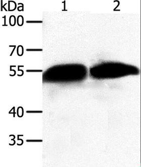 GC / Vitamin D-Binding Protein Antibody - Western blot analysis of Human fetal liver tissue and A549 cell, using GC Polyclonal Antibody at dilution of 1:500.