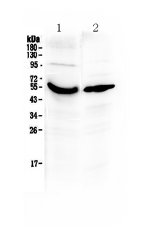 GC / Vitamin D-Binding Protein Antibody - Western blot - Anti-Vitamin D Binding protein Picoband Antibody