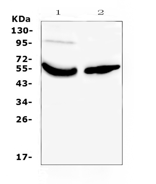 GC / Vitamin D-Binding Protein Antibody - Western blot analysis of Vitamin D Binding protein using anti-Vitamin D Binding protein antibody. Electrophoresis was performed on a 5-20% SDS-PAGE gel at 70V (Stacking gel) / 90V (Resolving gel) for 2-3 hours. The sample well of each lane was loaded with 50ug of sample under reducing conditions. Lane 1: human placenta tissue lysates,Lane 2: human A431 whole cell lysates. After Electrophoresis, proteins were transferred to a Nitrocellulose membrane at 150mA for 50-90 minutes. Blocked the membrane with 5% Non-fat Milk/ TBS for 1.5 hour at RT. The membrane was incubated with rabbit anti-Vitamin D Binding protein antigen affinity purified polyclonal antibody at 0.5 ug/mL overnight at 4?, then washed with TBS-0.1% Tween 3 times with 5 minutes each and probed with a goat anti-rabbit IgG-HRP secondary antibody at a dilution of 1:10000 for 1.5 hour at RT. The signal is developed using an Enhanced Chemiluminescent detection (ECL) kit with Tanon 5200 system. A specific band was detected for Vitamin D Binding protein at approximately 53KD. The expected band size for Vitamin D Binding protein is at 53KD.
