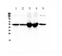 GC / Vitamin D-Binding Protein Antibody - Western blot - Anti-Gc/Vitamin D Bp Picoband antibody