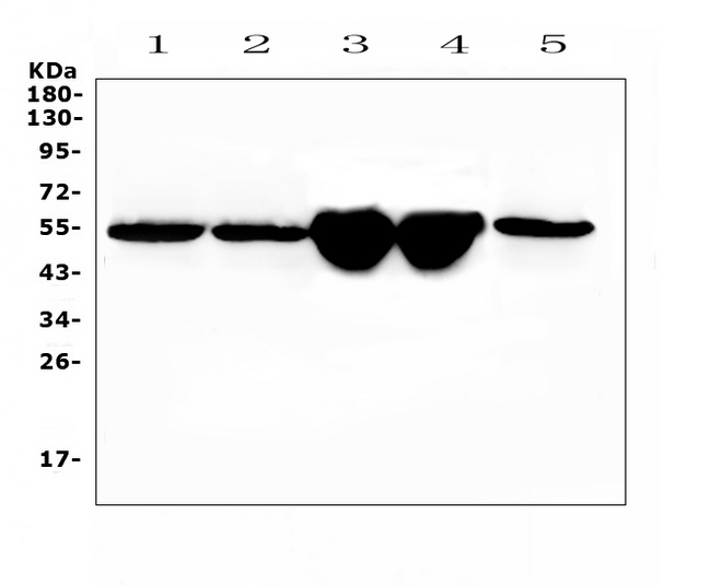 GC / Vitamin D-Binding Protein Antibody - Western blot analysis of Gc using anti-Gc antibody. Electrophoresis was performed on a 5-20% SDS-PAGE gel at 70V (Stacking gel) / 90V (Resolving gel) for 2-3 hours. The sample well of each lane was loaded with 50ug of sample under reducing conditions. Lane 1: rat liver tissue lysate,Lane 2: rat liver tissue lysate,Lane 3: mouse liver tissue lysate,Lane 4: mouse liver tissue lysate,Lane 5: human placenta tissue lysate. After Electrophoresis, proteins were transferred to a Nitrocellulose membrane at 150mA for 50-90 minutes. Blocked the membrane with 5% Non-fat Milk/ TBS for 1.5 hour at RT. The membrane was incubated with rabbit anti-Gc antigen affinity purified polyclonal antibody at 0.5 µg/mL overnight at 4°C, then washed with TBS-0.1% Tween 3 times with 5 minutes each and probed with a goat anti-rabbit IgG-HRP secondary antibody at a dilution of 1:10000 for 1.5 hour at RT. The signal is developed using an Enhanced Chemiluminescent detection (ECL) kit with Tanon 5200 system. A specific band was detected for Gc at approximately 53KD. The expected band size for Gc is at 53KD.