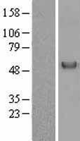 GC / Vitamin D-Binding Protein Protein - Western validation with an anti-DDK antibody * L: Control HEK293 lysate R: Over-expression lysate