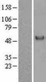 GC / Vitamin D-Binding Protein Protein - Western validation with an anti-DDK antibody * L: Control HEK293 lysate R: Over-expression lysate
