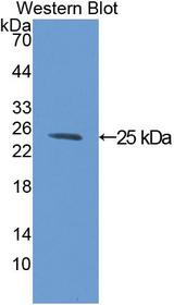 GC1qR / C1QBP Antibody