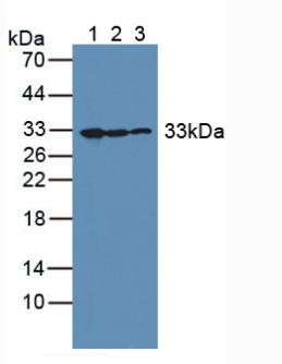 GC1qR / C1QBP Antibody - Western Blot; Sample: Lane1: Human K562 Cells; Lane2: Human Hela Cells; Lane3: Human Liver Tissue.