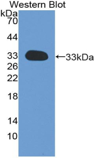 GC1qR / C1QBP Antibody - Western blot of recombinant GC1qR / C1QBP. This image was taken for the unconjugated form of this product. Other forms have not been tested.