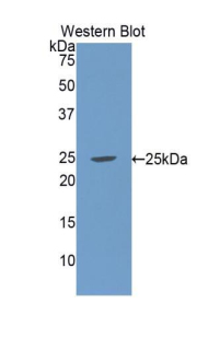 GC1qR / C1QBP Antibody - Western blot of recombinant GC1qR / C1QBP.  This image was taken for the unconjugated form of this product. Other forms have not been tested.