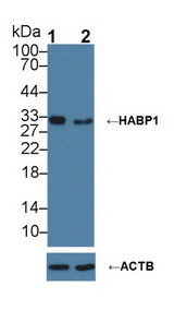 GC1qR / C1QBP Antibody - Knockout Varification: Lane 1: Wild-type Hela cell lysate; Lane 2: HABP1 knockout Hela cell lysate; Predicted MW: 31kDa ; Observed MW: 31kDa; Primary Ab: 1µg/ml Rabbit Anti-Human HABP1 Antibody; Second Ab: 0.2µg/mL HRP-Linked Caprine Anti-Rabbit IgG Polyclonal Antibody;