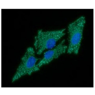 GC1qR / C1QBP Antibody - ICC/IF analysis of C1QBP in HeLa cells line, stained with DAPI (Blue) for nucleus staining and monoclonal anti-human C1QBP antibody (1:100) with goat anti-mouse IgG-Alexa fluor 488 conjugate (Green).