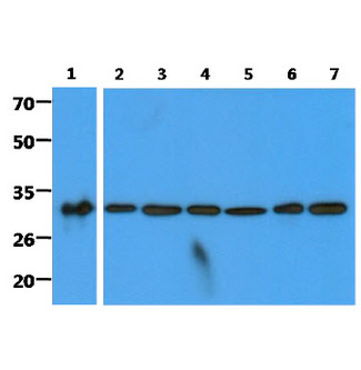 GC1qR / C1QBP Antibody - The recombinant protein(50ng) and cell lysates(40ug) were resolved by SDS-PAGE, transferred to PVDF membrane and probed with anti-human C1QBP antibody (1:2000). Proteins were visualized using a goat anti-mouse secondary antibody conjugated to HRP and an ECL detection system. Lane 1 : Recombinant protein Lane 2 : HeLa cell lysate Lane 3 : Jurkat cell lysate Lane 4 : MCF7 cell lysate Lane 5 : Ramos cell lysate Lane 6 : 293T cell lysate Lane 7 : A549 cell lysate