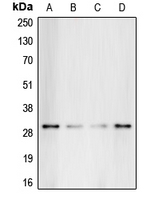 GC1qR / C1QBP Antibody - Western blot analysis of C1QBP expression in HeLa (A); HepG2 (B); Raji (C); K562 (D) whole cell lysates.