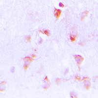 GC1qR / C1QBP Antibody - Immunohistochemical analysis of C1QBP staining in human brain formalin fixed paraffin embedded tissue section. The section was pre-treated using heat mediated antigen retrieval with sodium citrate buffer (pH 6.0). The section was then incubated with the antibody at room temperature and detected using an HRP conjugated compact polymer system. DAB was used as the chromogen. The section was then counterstained with hematoxylin and mounted with DPX.