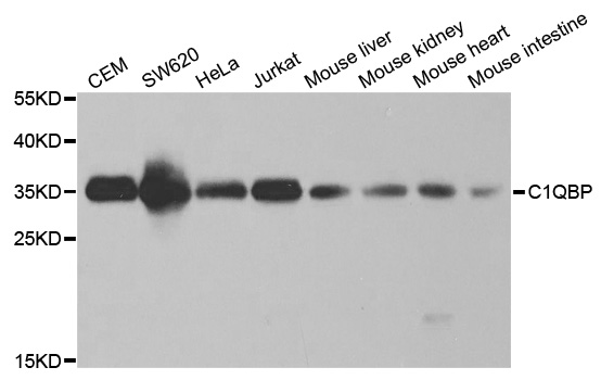 GC1qR / C1QBP Antibody - Western blot analysis of extracts of various cell lines.