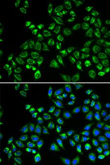 GC1qR / C1QBP Antibody - Immunofluorescence analysis of HeLa cells.