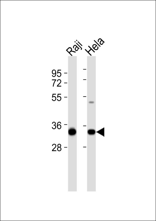 GC1qR / C1QBP Antibody - All lanes : Anti-C1QBP Antibody at 1:1000 dilution Lane 1: Raji whole cell lysates Lane 2: HeLa whole cell lysates Lysates/proteins at 20 ug per lane. Secondary Goat Anti-Rabbit IgG, (H+L),Peroxidase conjugated at 1/10000 dilution Predicted band size : 31 kDa Blocking/Dilution buffer: 5% NFDM/TBST.