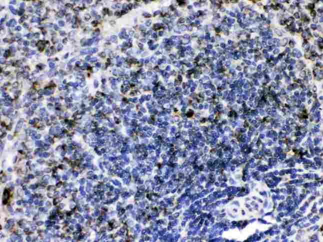 GC1qR / C1QBP Antibody - GC1q R was detected in paraffin-embedded sections of rat spleen tissues using rabbit anti- GC1q R Antigen Affinity purified polyclonal antibody