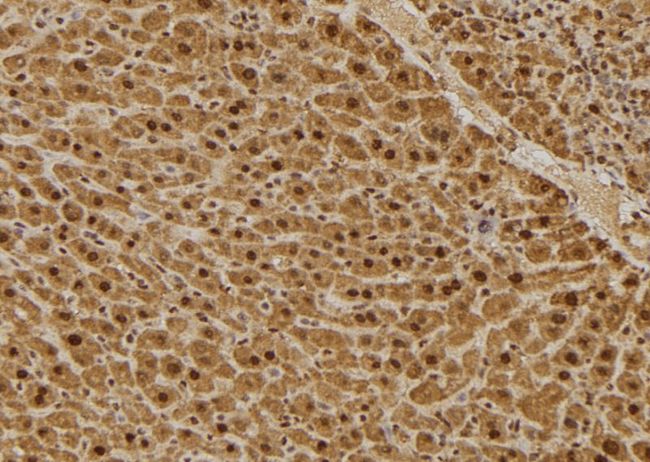 GC1qR / C1QBP Antibody - 1:100 staining mouse liver tissue by IHC-P. The sample was formaldehyde fixed and a heat mediated antigen retrieval step in citrate buffer was performed. The sample was then blocked and incubated with the antibody for 1.5 hours at 22°C. An HRP conjugated goat anti-rabbit antibody was used as the secondary.