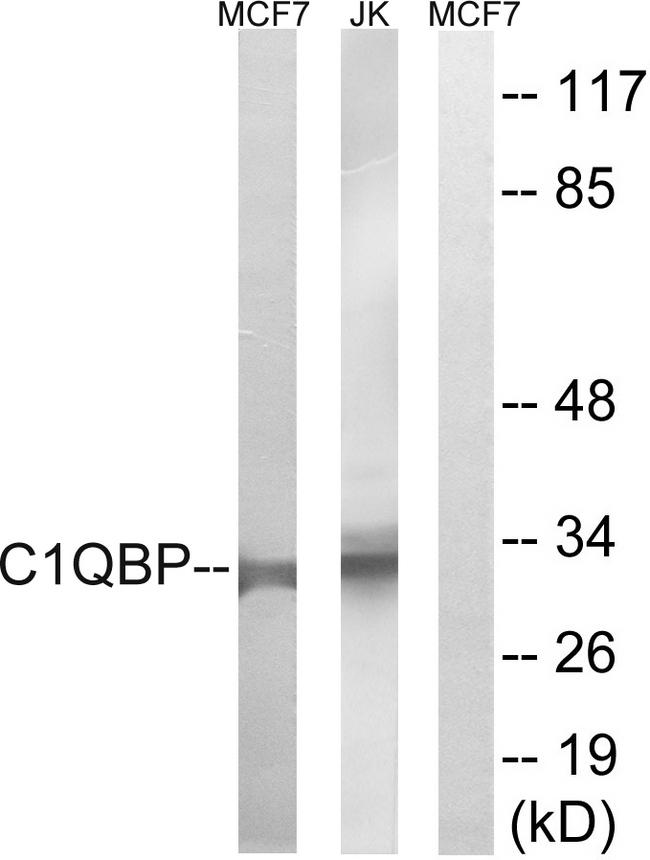 GC1qR / C1QBP Antibody - Western blot analysis of extracts from Jurkat cells and HUVEC cells, using C1QBP antibody.