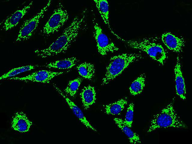 GC1qR / C1QBP Antibody - Immunofluorescence staining of His-mC1QBP in NIH-3T3 cells. Cells were fixed with 4% PFA, permeabilzed with 0.1% Triton X-100 in PBS, blocked with 10% serum, and incubated with rabbit anti-MOUSE His-mC1QBP polyclonal antibody (dilution ratio 1:1000) at 4°C overnight. Then cells were stained with the Alexa Fluor 488-conjugated Goat Anti-rabbit IgG secondary antibody (green) and counterstained with DAPI (blue). Positive staining was localized to cytoplasm.