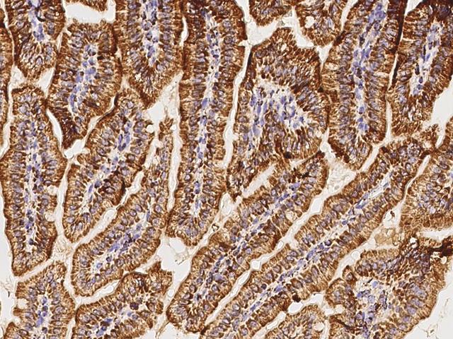 GC1qR / C1QBP Antibody - Immunochemical staining of mouse C1QBP in mouse small intestine with rabbit polyclonal antibody at 1:1000 dilution, formalin-fixed paraffin embedded sections.