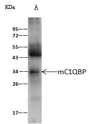 GC1qR / C1QBP Antibody - mC1QBP was immunoprecipitated using: Lane A: 0.5 mg Jurkat Whole Cell Lysate. 2 uL anti-mC1QBP rabbit polyclonal antibody and 60 ug of Immunomagnetic beads Protein A/G. Primary antibody: Anti-mC1QBP rabbit polyclonal antibody, at 1:100 dilution. Secondary antibody: Goat Anti-Rabbit IgG (H+L)/HRP at 1/10000 dilution. Developed using the ECL technique. Performed under reducing conditions. Predicted band size: 31 kDa. Observed band size: 34 kDa.