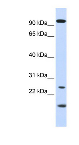 GCAP / GUCA1A Antibody - GUCA1A / GCAP1 antibody Western blot of Fetal Kidney lysate. This image was taken for the unconjugated form of this product. Other forms have not been tested.