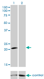 GCAP / GUCA1A Antibody - Western blot analysis of GUCA1A over-expressed 293 cell line, cotransfected with GUCA1A Validated Chimera RNAi (Lane 2) or non-transfected control (Lane 1). Blot probed with GUCA1A monoclonal antibody (M04), clone 2F7 . GAPDH ( 36.1 kDa ) used as specificity and loading control.