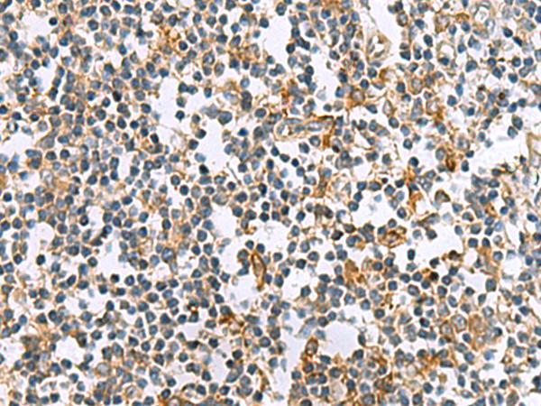GCAP / GUCA1A Antibody - Immunohistochemistry of paraffin-embedded Human tonsil tissue  using GUCA1A Polyclonal Antibody at dilution of 1:105(×200)