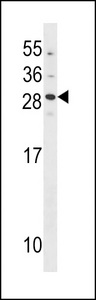 GCAP2 / GUCA1B Antibody - GUCA1B Antibody western blot of A549 cell line lysates (35 ug/lane). The GUCA1B antibody detected the GUCA1B protein (arrow).