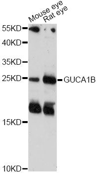 GCAP2 / GUCA1B Antibody - Western blot analysis of extracts of various cell lines, using GUCA1B antibody at 1:1000 dilution. The secondary antibody used was an HRP Goat Anti-Rabbit IgG (H+L) at 1:10000 dilution. Lysates were loaded 25ug per lane and 3% nonfat dry milk in TBST was used for blocking. An ECL Kit was used for detection and the exposure time was 3min.