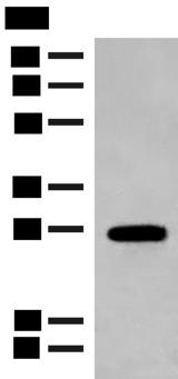 GCAP2 / GUCA1B Antibody - Western blot analysis of Mouse eye tissue lysate  using GUCA1B Polyclonal Antibody at dilution of 1:500