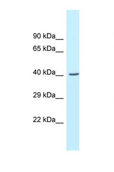 GCAT Antibody - GCAT antibody Western blot of Mouse Pancreas lysate. Antibody concentration 1 ug/ml.  This image was taken for the unconjugated form of this product. Other forms have not been tested.