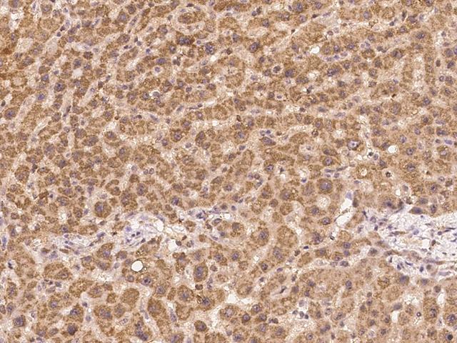 GCAT Antibody - Immunochemical staining of human GCAT in human liver with rabbit polyclonal antibody at 1:100 dilution, formalin-fixed paraffin embedded sections.