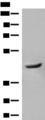 GCAT Antibody - Western blot analysis of Human fetal liver tissue lysate  using GCAT Polyclonal Antibody at dilution of 1:400