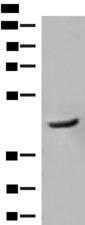 GCAT Antibody - Western blot analysis of Human fetal liver tissue lysate  using GCAT Polyclonal Antibody at dilution of 1:400