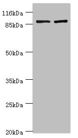 GCC1 / GCC88 Antibody - Western blot All Lanes:GCC1 antibody at 2ug/ml Lane 1:Hela cells Lane 2:293T cells Secondary Goat polyclonal to rabbit at 1/10000 dilution Predicted band size: 88kDa Observed band size: 88kDa