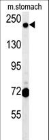 GCC2 Antibody - GCC2 Antibody western blot of mouse stomach tissue lysates (15 ug/lane). The GCC2 antibody detected GCC2 protein (arrow).
