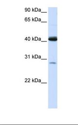 GCD / GCDH Antibody - 293T cell lysate. Antibody concentration: 1.0 ug/ml. Gel concentration: 12%.  This image was taken for the unconjugated form of this product. Other forms have not been tested.