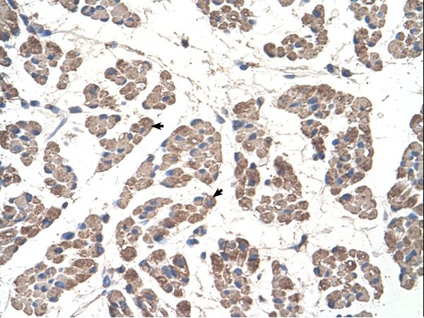 GCD / GCDH Antibody - GCDH antibody GCDH(glutaryl-Coenzyme A dehydrogenase) Antibody was used in IHC to stain formalin-fixed, paraffin-embedded human muscle.  This image was taken for the unconjugated form of this product. Other forms have not been tested.