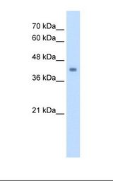 GCD / GCDH Antibody - HepG2 cell lysate. Antibody concentration: 2.5 ug/ml. Gel concentration: 12%.  This image was taken for the unconjugated form of this product. Other forms have not been tested.