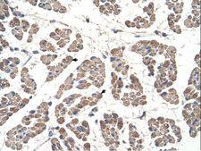 GCD / GCDH Antibody - GCDH antibody GCDH(glutaryl-Coenzyme A dehydrogenase) Antibody was used in IHC to stain formalin-fixed, paraffin-embedded human muscle.  This image was taken for the unconjugated form of this product. Other forms have not been tested.