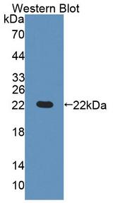 GCD / GCDH Antibody - Western Blot; Sample: Recombinant protein.
