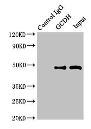 GCD / GCDH Antibody - Immunoprecipitating GCDH in Hela whole cell lysate Lane 1: Rabbit monoclonal IgG (1µg) instead of GCDH Antibody in Hela whole cell lysate.For western blotting, a HRP-conjugated Protein G antibody was used as the secondary antibody (1/2000) Lane 2: GCDH Antibody (8µg) + Hela whole cell lysate (500µg) Lane 3: Hela whole cell lysate (10µg)
