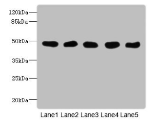 GCD / GCDH Antibody - Western Blot All lanes: GCDH antibody at 8µg/ml Lane 1: Mouse kidney tissue Lane 2: Mouse liver tissue Lane 3: Hela whole cell lysate Lane 4: MCF-7 whole cell lysate Lane 5: LO2 whole cell lysate Secondary Goat polyclonal to rabbit IgG at 1/10000 dilution Predicted band size: 49, 48 kDa Observed band size: 49 kDa