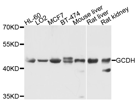 GCD / GCDH Antibody - Western blot analysis of extracts of various cells.