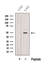 GCD / GCDH Antibody - Western blot analysis of extracts of L02 cells using GCDH antibody. The lane on the left was treated with blocking peptide.